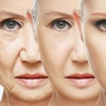 Mezolifting cilde canlılık kazandırır mı?